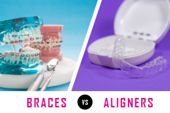 Fort Worth, TX dentist, Dr. Green at Fort Worth Cosmetic & Family Dentistry, talks about what factors need to be considered when deciding between getting braces or clear aligners for corrections.