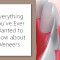 Everything You’ve Ever Wanted to Know about Veneers (featured image)